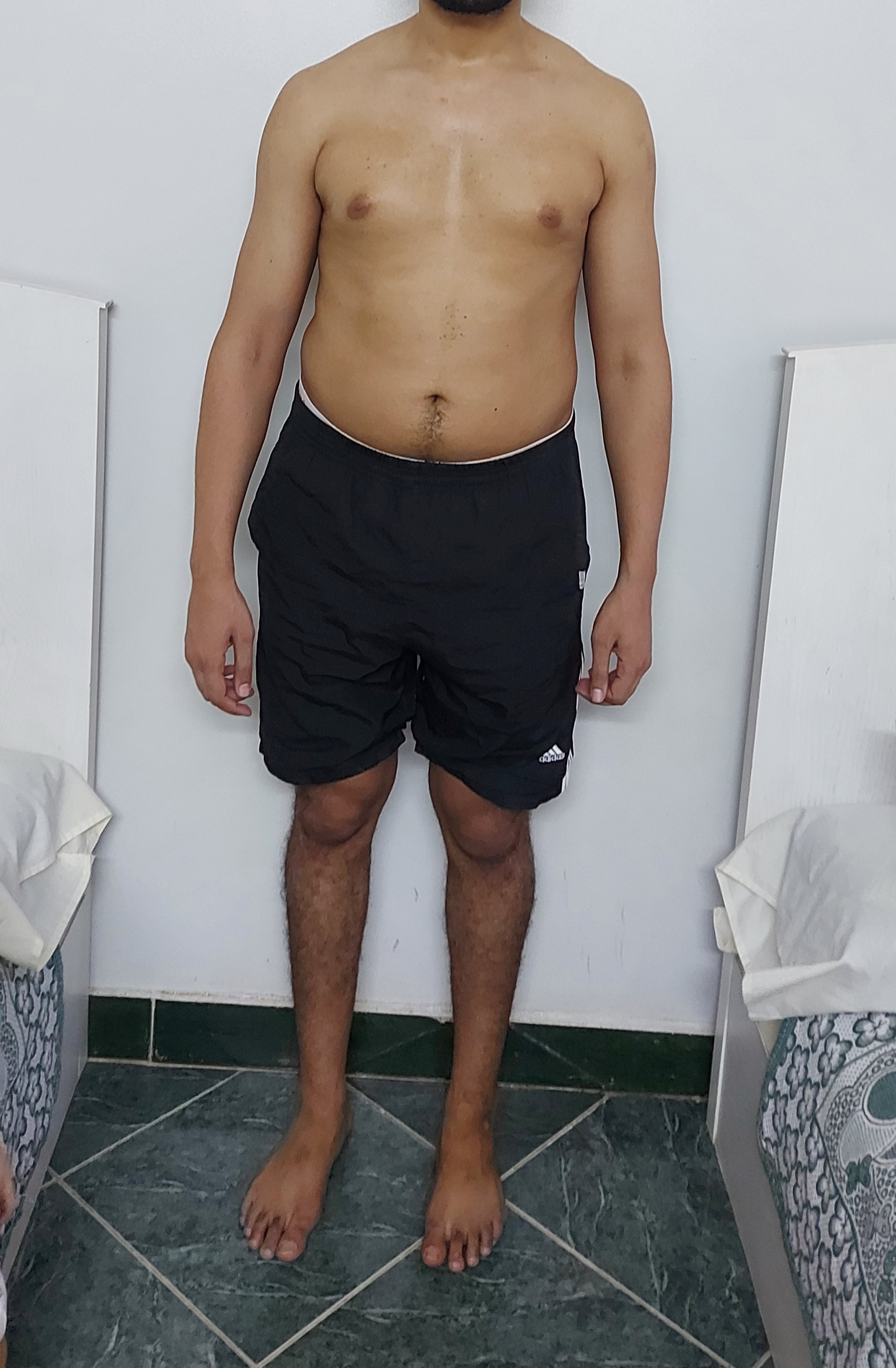 transformation