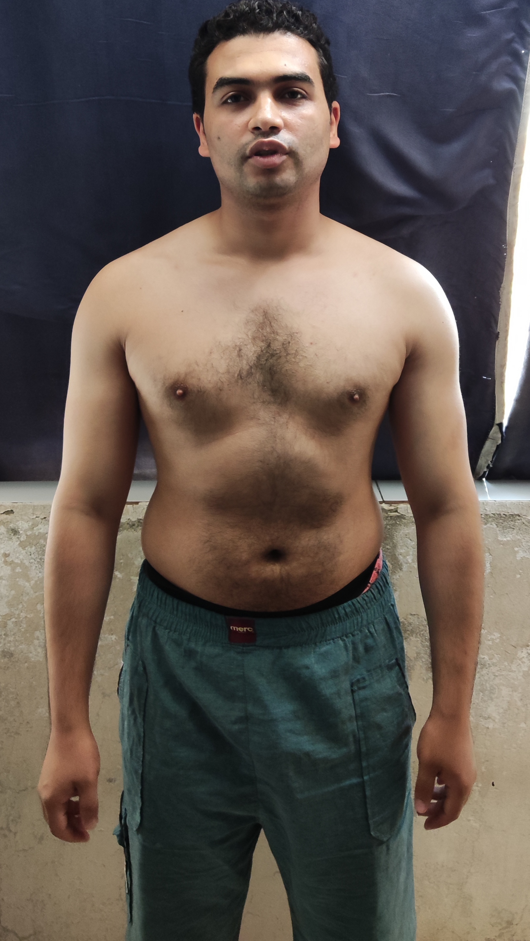 transformation